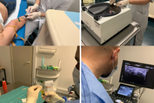 Le traitement par Plasma Riche en Plaquettes (PRP)